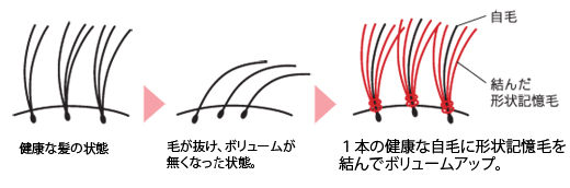 フェルモ結び目イメージ